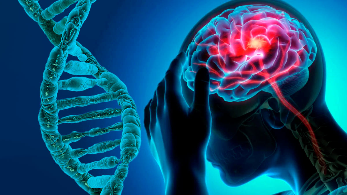 Российские ученые нашли ген, отвечающий за тяжесть инсульта